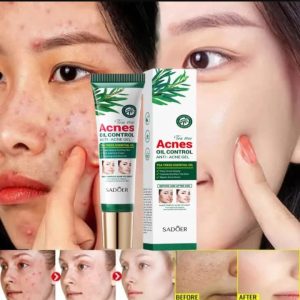 Acne oile control gel